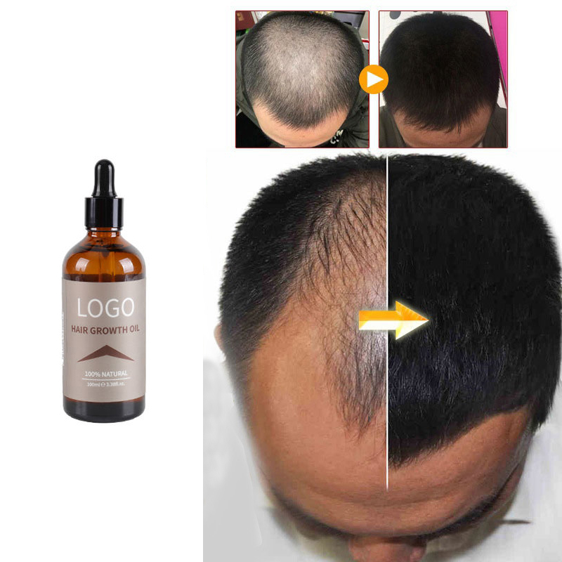 Suero para el crecimiento del cabello