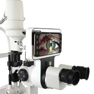 Oferta Especial: Instrumento Óptico Digital de Lámpara de Hendidura para Pruebas Oculares, Módulo de Sistema de Imagen de Lámpara de Hendidura para Smartphone con Android - Product Image 4
