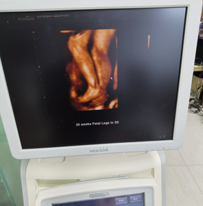 Servicio de Reparación de Máquinas de Ultrasonido Medison V20 - Product Image 1