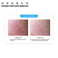 Collagène recombinant humanisé de type III en spray, solution efficace pour la réparation de la barrière cutanée, récupération après soleil pour adultes, tous types de peau
