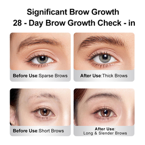 आईब्रो विकास सीरम पलक बाल विकास विरोधी बालों की वृद्धि विरोधी बालों की हानि उत्पाद गंजापन को रोकता है - Product Image 3