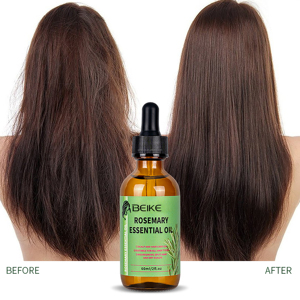 BEIKE OEM, Fabricantes de Aceite Capilar Natural, Productos para el Cuidado del Cabello, Suplemento para el Crecimiento, Suero de Romero para el Crecimiento del Cabello, Aceite de Romero - Product Image 1