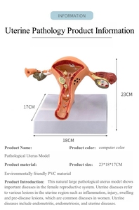 Phòng thí nghiệm công cụ giảng dạy phụ khoa mô hình tử cung bệnh lý con người Mô hình giải phẫu cơ quan sinh sản nữ Sản phẩm khoa học y tế - Product Image 5