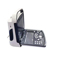 Ecógrafo Médico Mindray DP10 de Uso Humano Instrumentos de Ultrasonido en Blanco y Negro Precio de Máquina de Ultrasonido Portátil Escáner Veterinario