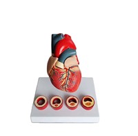 Modelo de Enseñanza Médica de Corazón con Trombosis, Simulador Realista de Patología Cardíaca para Entrenamiento de Cardiología CE/ISO