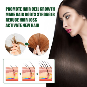 Regrow 7 Day Jengibre <span class=keywords><strong>Germinal</strong></span> Serum Nutritivo Masaje del Cuero Cabelludo Raíces Cuidado Esencia 30ML 1 FlOz Jengibre Crecimiento del Cabello Aceite <span class=keywords><strong>Germinal</strong></span> - Product Image 5