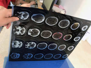 Processore di pellicole termiche per CT, MRI, raggi <span class=keywords><strong>X</strong></span>, apparecchiature radiologiche per immagini a secco, stampante di pellicole termiche a secco, sistema digitale DR per raggi <span class=keywords><strong>X</strong></span> - Product Image 5