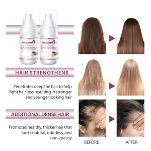 Huyết Thanh Mọc Tóc Người <span class=keywords><strong>Biotin</strong></span> Dành Cho Tóc Mọc Lại Tóc Mỏng Và Hói Đầu Hoa Văn - Product Image 2