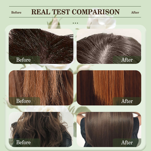 Factory Hot Selling Hair Care Set 2025 Organic Herbal Ginger <strong>Shampoo</strong> Oil-control Anti Dandruff Natural Sulphate Free <strong>Shampoo</strong> - Product Image 6
