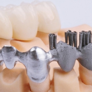 <span class=keywords><strong>Riton</strong></span>-impresora 3d de metal para odontología, D-120 equipo dental, slm, digital - Product Image 6