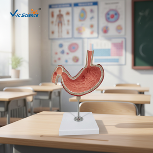 Modelli Anatomici per l'Insegnamento Medico: Modello di Stomaco con <span class=keywords><strong>Ulcere</strong></span>, Modello Anatomico del Sistema Digestivo - Product Image 6