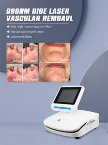 Keylaser 980nm Diode Laser Vascular <strong>Removal</strong> Spider Veins <strong>Removal</strong> <strong>Blood</strong> Vessels <strong>Removal</strong> Machine - Product Image 6