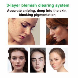 Kem làm sáng da cho các đốm đen trên mặt-Axit Azelaic với axit Kojic, axit Tranexamic Niacinamide, đốm nắng - Product Image 5