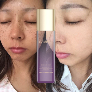 Lait d'essence multi-effets éclaircissant et anti-taches OEM/ODM pour le <span class=keywords><strong>soin</strong></span> du <span class=keywords><strong>visage</strong></span> féminin, éclaircissant et anti-imperfections - Product Image 2