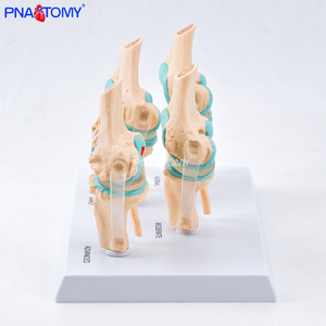 Modelo de Articulación de <span class=keywords><strong>Rodilla</strong></span> Humana de 4 Etapas con Osteoartritis Patológica, Herramienta Educativa para Profesores de Ciencias Anatómicas, Enseñanza Médica - Product Image 3