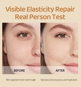 Siero Viso all'Acido Kojico, Curcuma e Niacinamide 80ml, Anti-Acne, Sbiancante, Anti-Macchie Scure, Siero per la Cura della Pelle - Product Image 2