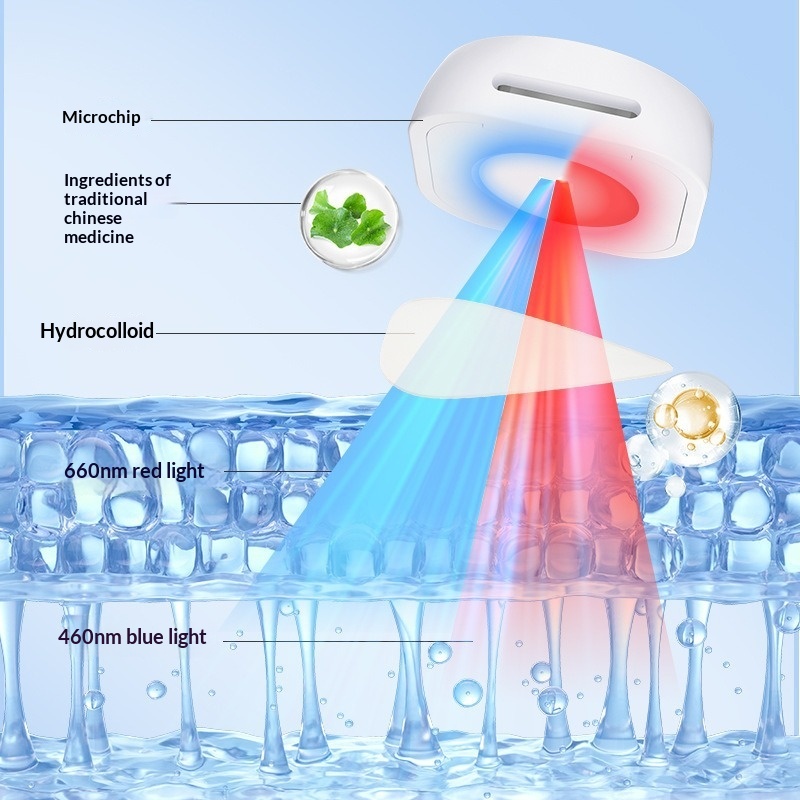 electronic acne patch