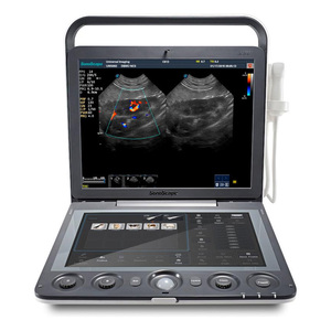Sonoscape S9V Reusable Intelligent Veterinary <b>Ultrasound</b> Platform with Streamlined Diagnostic Workflow - Product Image 6