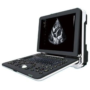 Longermay thú y xách tay đầy đủ kỹ thuật số siêu âm chẩn đoán Scanner - Product Image 1