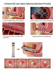 Nuevo producto 2 en 1 tratamiento láser fraccional + interruptor máquina de belleza para el cuidado de la piel tratamiento de pecas muebles de salón - Product Image 5