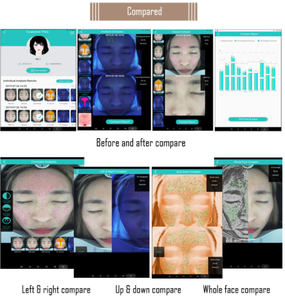 Analizador de Piel Facial 3D Profesional Portátil, Escáner de Diagnóstico de Piel para Medir la Humedad, Grasa y Poros, Equipo para Salón de Belleza - Product Image 6