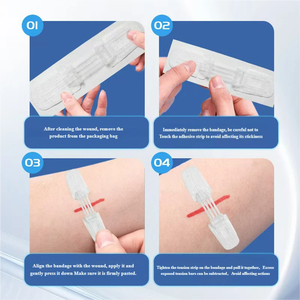 Cierres de Heridas de Emergencia con Cierre de Cremallera, Indoloros, Ajustables, Envueltos Individualmente y de Alta Adhesión, Aptos <span class=keywords><strong>para</strong></span> Primeros Auxilios y Cuidado de Heridas - Product Image 5