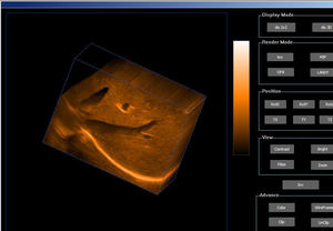 Mesin <span class=keywords><strong>Ultrasound</strong></span> Digital <span class=keywords><strong>3D</strong></span> <span class=keywords><strong>4D</strong></span> Medis Profesional untuk Hewan Warna/Hitam Putih untuk Manusia/Kedokteran Hewan - Product Image 4
