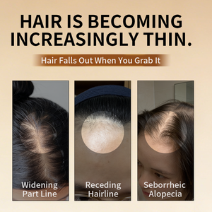 Huile Capillaire Végétale GREENLEM à Marque Blanche pour la Croissance des Cheveux, au Romarin et aux Graines Noires, Traitement Naturel et Biologique Sans Huile pour Cheveux Secs, OEM - Product Image 3