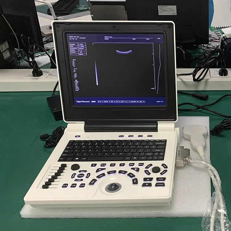 超音波スキャナ医療用フルデジタルポータブル白黒3D