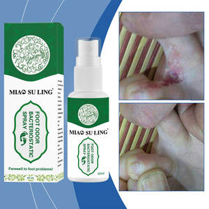 Venta al por mayor mata bacterias y refresca el olor; previene hongos y alivia la fatiga. Spray desodorante para pies después del <span class=keywords><strong>ejercicio</strong></span> - Product Image 2