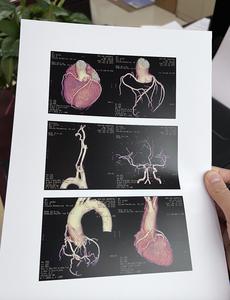 CT/CR/<span class=keywords><strong>DR</strong></span>/x射线/b超/彩色超声拉伸薄膜防水防静电半透明白色PET激光医用薄膜 - Product Image 3