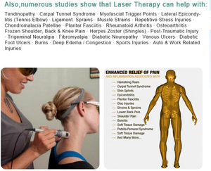Điều trị bằng <span class=keywords><strong>laser</strong></span> cao Pain Relief Class 4 <span class=keywords><strong>Laser</strong></span> trị liệu hệ thống 60 Wát multiwave công suất cao vật lý trị liệu <span class=keywords><strong>980nm</strong></span> 635nm <span class=keywords><strong>Diode</strong></span> <span class=keywords><strong>Laser</strong></span> - Product Image 2