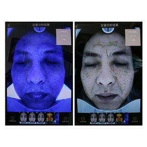 ใหม่เครื่องสแกนผิวหนังอัจฉริยะแบบพกพา, เครื่องสแกนผิวระบบดิจิทัลโคมไฟไม้ขายดีสำหรับเครื่องสแกนผิวแบบวิเซียใช้งานง่าย - Product Image 4