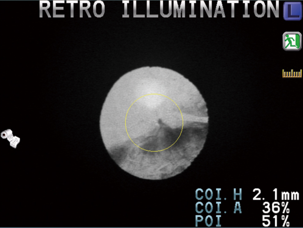 ark 1s autorefractor fully automatic