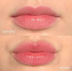 ลิปอินเจคชั่นเพิ่มความชุ่มชื้นและอวบอิ่มแบบออริจินัล ลิปกลอสเพิ่มความอวบอิ่มสูตรเข้มข้น พร้อมรับผลิตแบรนด์ส่วนตัว - Product Image 3