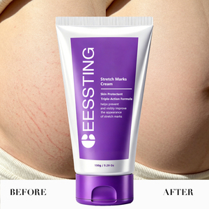 Crème Corporelle Hydratante en Profondeur pour Femmes Enceintes, Formule Douce Naturelle, Réduit les Vergetures, Raffermit le Ventre, Soin Maternité en Gros - Product Image 2