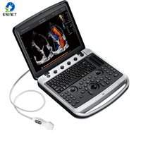 Ecógrafo Portátil Eléctrico EURVET Chison Color Doppler 3D/4D SonoBook9 con Sonda Convexa de Metal
