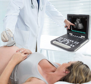 Đầy đủ kỹ thuật số máy tính xách tay máy quét siêu âm SS-10 - Product Image 6