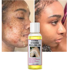 Minyak Pengelupas OEM Yellow Peeling Oil <span class=keywords><strong>Vitamin</strong></span> C <span class=keywords><strong>Vitamin</strong></span> <span class=keywords><strong>E</strong></span> Pemutih Buku-buku Jari Melembapkan Menghilangkan Flek Hitam Minyak Pengelupas Ekstra Kuat - Product Image 1