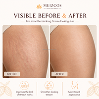 Lotion corporelle raffermissante hypoallergénique naturelle OEM ODM, beurre de massage pour vergetures, soin bio pour la peau pendant la grossesse