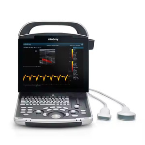 เครื่องอัลตราซาวนด์สัตวแพทย์ DP-10 สำหรับส่งออก ระบบวินิจฉัยด้วยอัลตราซาวนด์แบบดิจิทัลเต็มรูปแบบ พกพาสะดวก ภาพขาวดำ พร้อม - Product Image 4