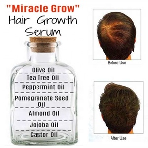 Aceite de Elilxir para el crecimiento del cabello, suero de tratamiento para la pérdida de cabello, aceite orgánico Natural, Etiqueta Privada - Product Image 3
