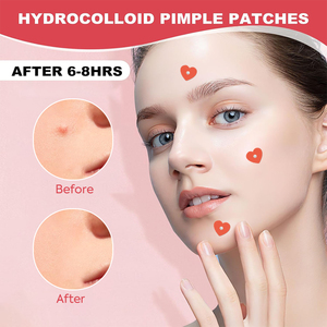 4 toppe colorate <span class=keywords><strong>Per</strong></span> scatola a forma di cuore brufolo Patch con custodia in plastica con specchio - Product Image 6