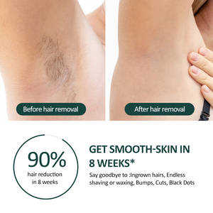 Appareil professionnel d'épilation Laser IPL marque privée usage domestique beauté lumière pulsée intense Portable pour application domestique - Product Image 4