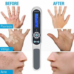 Lampu tembak biji Vitiligo, perawatan UVB 311nm KN-4003BL penggunaan di rumah perangkat fototerapi UV Vitiligo Psoriasis lampu UVB - Product Image 5
