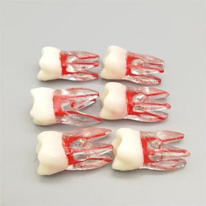 Modèle dentaire Heidefee à pulpe ouverte en silicone médical pour la pratique anatomique des canaux radiculaires et la formation en examen dentaire - Product Image 1