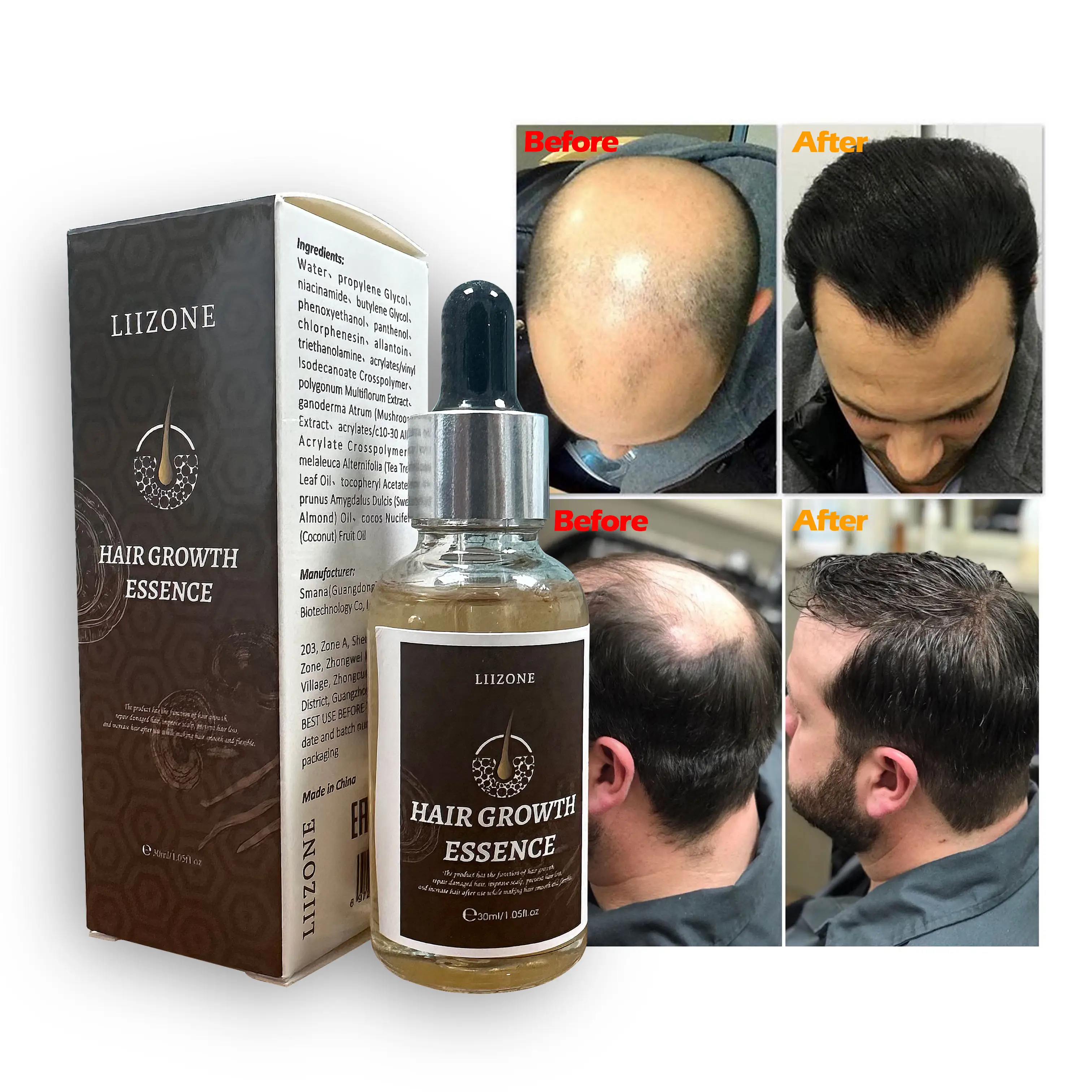 LIIZONE OEM Private Label 100% Natural Castor Oil Nourishing Scalp Elixirs Hair Care Loss Treatment Hair Growth Oil Serum