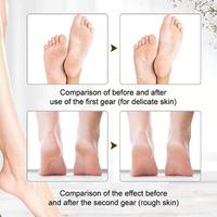 Outils de soin des pieds Machine électronique d'élimination des callosités des pieds Removedor De Callos Élimination des peaux mortes Meuleuse de pieds électrique