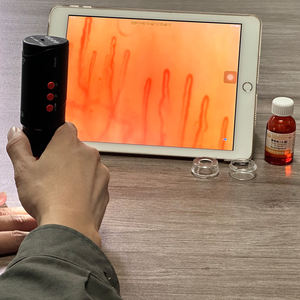高倍率本物の400X血流モニタリング装置キャピラリー顕微鏡はAndroid iPhone iPadで動作します - Product Image 2