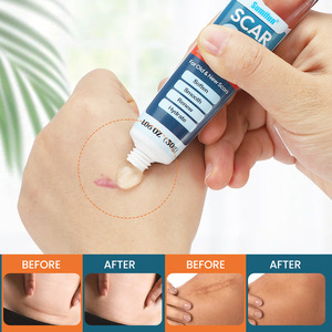 Vente en gros organique vergetures taches de rousseur pigmentation acné élimination des cicatrices crème gel pour les vieilles cicatrices - Product Image 5